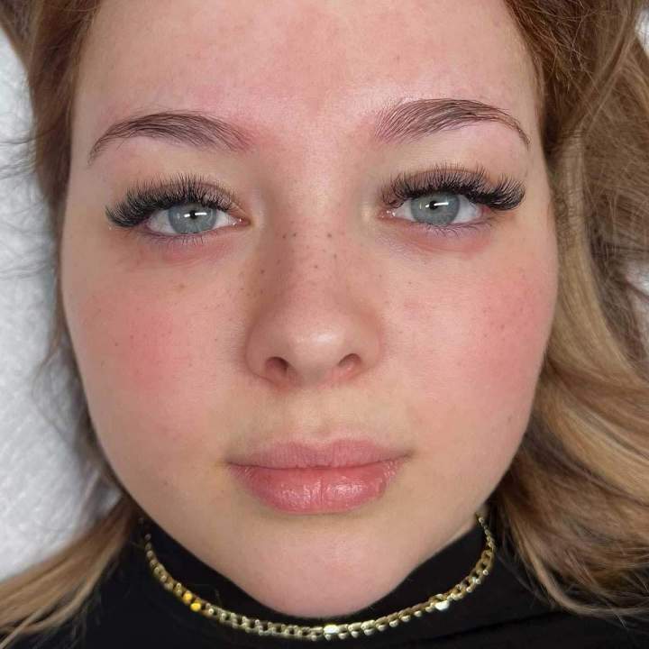Dermopigmentation Limoilou